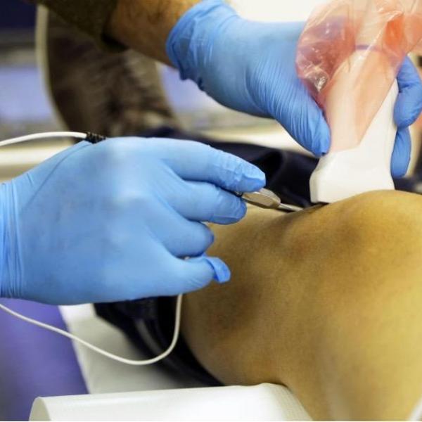 electrolisis-percutanea-ecoguiada